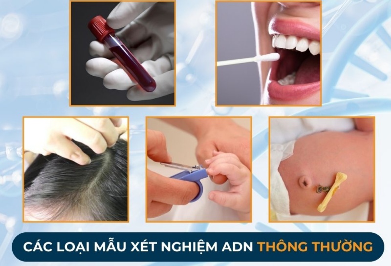 Dịch vụ lấy bằng chứng ADN 4 mau xet nghiem adn chinhhxac