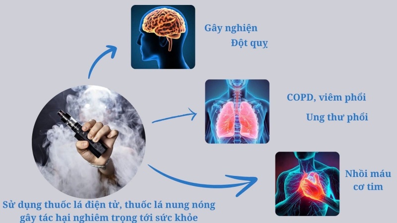 thuoc la dien tu